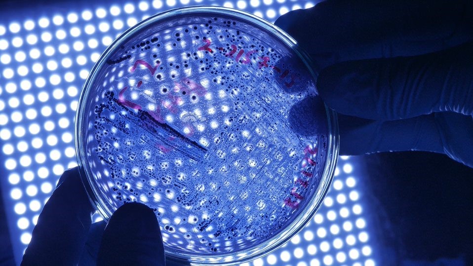 Close up of person holding petri dish with Legionella sample